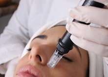 dermapen
